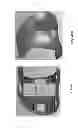 Fig. 67 - Patient-adapted and improved articular implants, designs and related guide tools