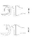 Fig. 68 - Patient-adapted and improved articular implants, designs and related guide tools