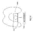 Fig. 69 - Patient-adapted and improved articular implants, designs and related guide tools