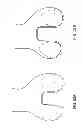 Fig. 70 - Patient-adapted and improved articular implants, designs and related guide tools
