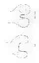 Fig. 71 - Patient-adapted and improved articular implants, designs and related guide tools