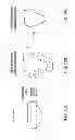 Fig. 83 - Patient-adapted and improved articular implants, designs and related guide tools