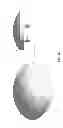 Fig. 84 - Patient-adapted and improved articular implants, designs and related guide tools