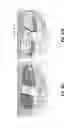 Fig. 89 - Patient-adapted and improved articular implants, designs and related guide tools