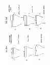 Fig. 93 - Patient-adapted and improved articular implants, designs and related guide tools