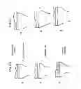 Fig. 95 - Patient-adapted and improved articular implants, designs and related guide tools