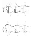 Fig. 96 - Patient-adapted and improved articular implants, designs and related guide tools