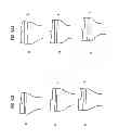 Fig. 97 - Patient-adapted and improved articular implants, designs and related guide tools