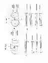 Fig. 98 - Patient-adapted and improved articular implants, designs and related guide tools
