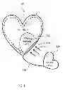 Fig. 02 - Pillow Apparatus Having An Insertable Pillow
