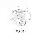 Fig. 05 - Pedicure Sock and Uses Thereof