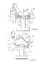 Fig. 02 - PRONE AND LATERALLY ANGLED SURGICAL DEVICE AND METHOD