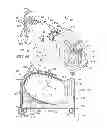 Fig. 06 - PRONE AND LATERALLY ANGLED SURGICAL DEVICE AND METHOD