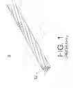 Fig. 02 - Method of terminating a stranded synthetic filament cable