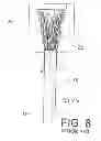 Fig. 09 - Method of terminating a stranded synthetic filament cable