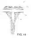 Fig. 43 - Method of terminating a stranded synthetic filament cable