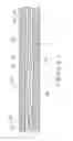 Fig. 06 - Temporary stimulation lead with polymer electrodes and method of manufacture