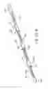 Fig. 07 - Temporary stimulation lead with polymer electrodes and method of manufacture