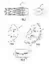 Fig. 02 - Method of extending life of rotating parts