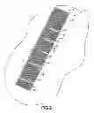 Fig. 03 - System and method of concrete crack repair
