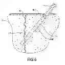 Fig. 05 - System and method of concrete crack repair