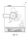 Fig. 17 - Systems for capsule pressure-relief
