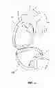 Fig. 05 - Friendship bracelet
