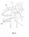 Fig. 06 - Friendship bracelet