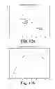 Fig. 09 - Systems, devices, and methods for designing and forming a surgical implant