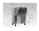 Fig. 01 - Dual oxygen concentrator systems and methods