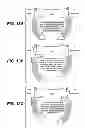 Fig. 16 - Surf wake system for a watercraft