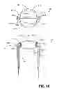 Fig. 11 - Universal capless refueling funnel