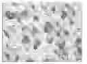 Fig. 01 - Porous surface layers with increased surface roughness and implants incorporating the same