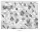 Fig. 03 - Porous surface layers with increased surface roughness and implants incorporating the same