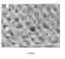 Fig. 07 - Porous surface layers with increased surface roughness and implants incorporating the same