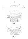 Fig. 09 - Method for forming cushions