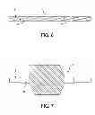 Fig. 05 - Catheter balloons with integrated non-distensible seals