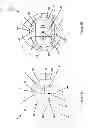 Fig. 06 - Hybrid rolling cone drill bits and methods for manufacturing same