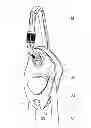 Fig. 01 - Safety device on a rope with blocking under load