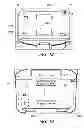 Fig. 09 - Portable dialysis machine
