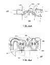 Fig. 33 - Portable dialysis machine