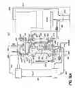 Fig. 65 - Portable dialysis machine