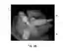 Fig. 03 - Automatic identification system for randomly oriented objects