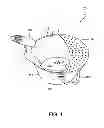 Fig. 02 - Combination Bucket