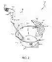 Fig. 03 - Combination Bucket