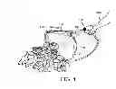 Fig. 05 - Combination Bucket