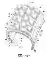 Fig. 02 - Method and tire for improved uniformity and endurance of aggressive tread designs