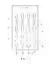 Fig. 09 - Method for producing a toothbrush having an inner cavity