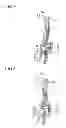 Fig. 06 - Door outer handle apparatus for vehicle