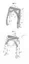 Fig. 02 - Frame structure for backrest and method for manufacturing the same
